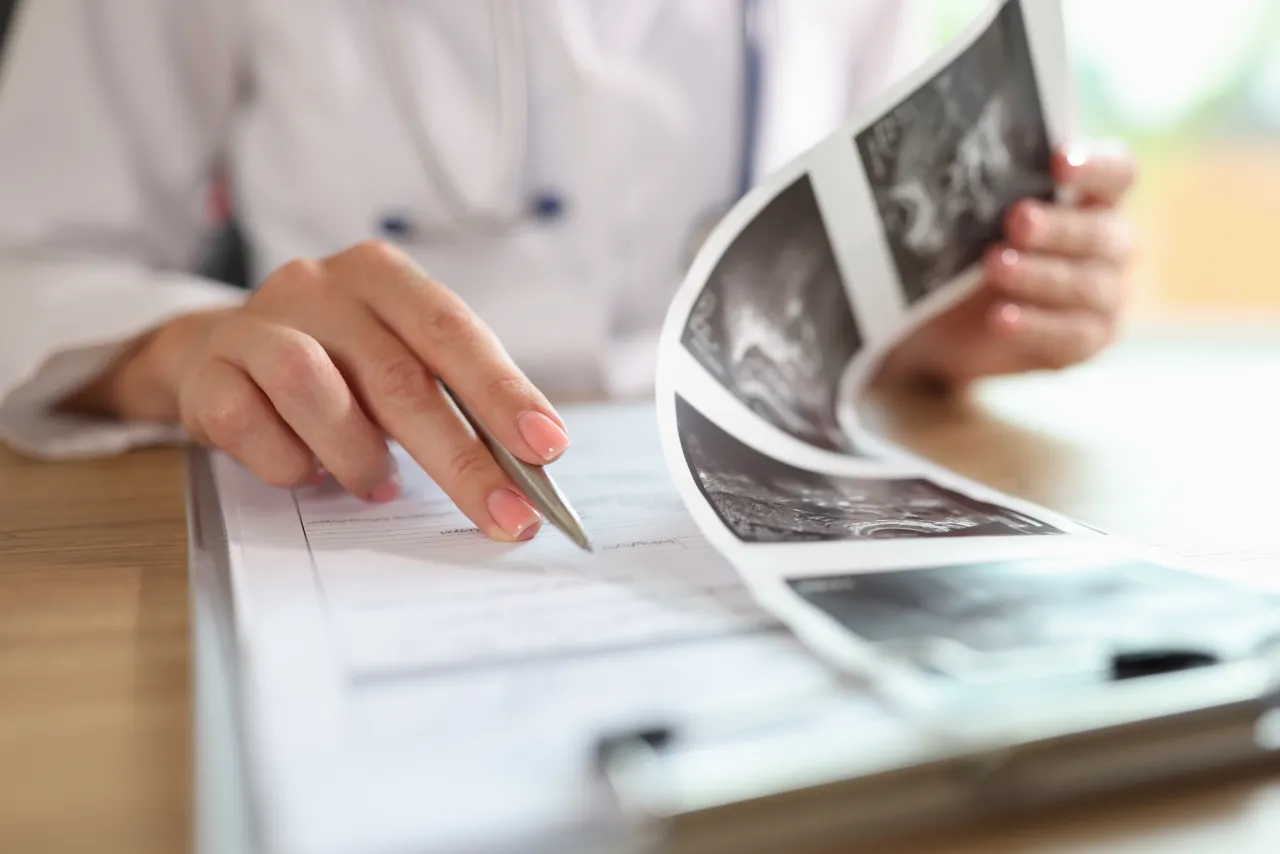 Specialist examining the results of a uterine ultrasound