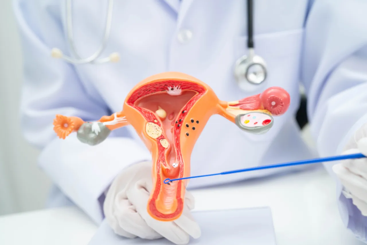 Doctor pointing to an anatomical model of the uterus