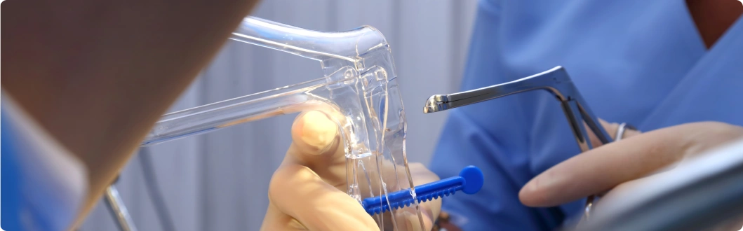 Cervical Dysplasia (CIN)