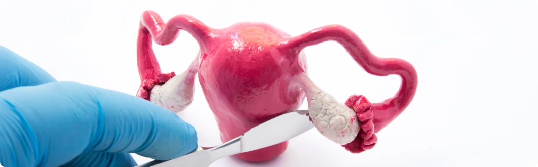 Cystectomy (Ovarian Cyst Removal)